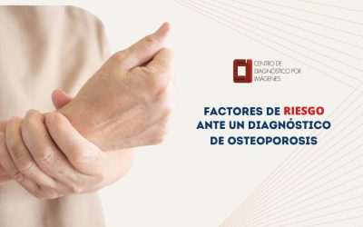 Factores de riesgo ante un diagnóstico de osteoporosis